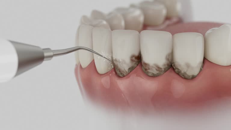 Reliable Tooth Extraction contractor in East Baton Rouge Parish County, LA by Dentist Open Now